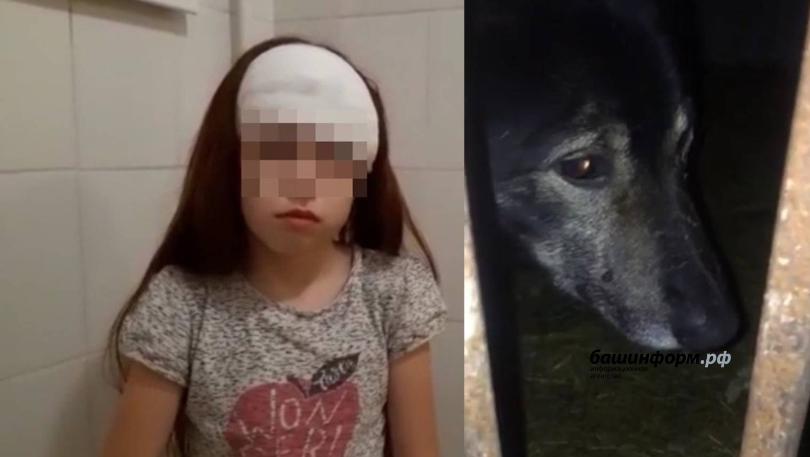 В Уфе отец пострадавшей от укусов собаки девочки сообщил, что сейчас происходит с его ребенком